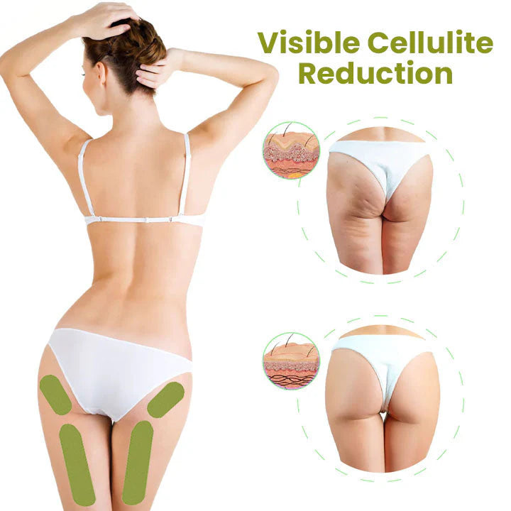 HerbalFirm Cellulite Buster Patch