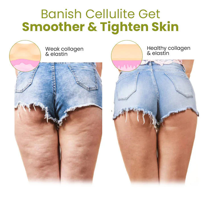 HerbalFirm Cellulite Buster Patch